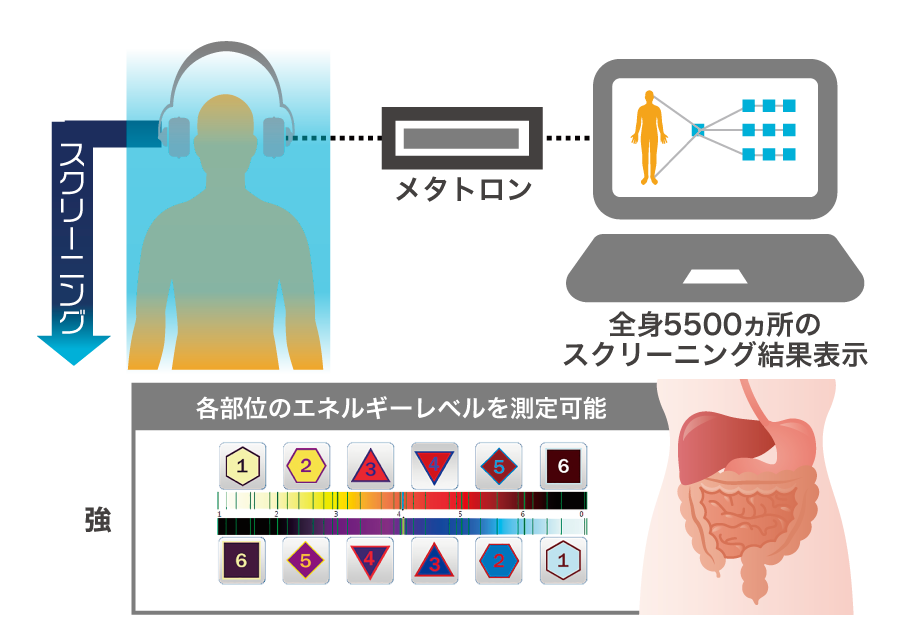 メタトロンの原理の図2